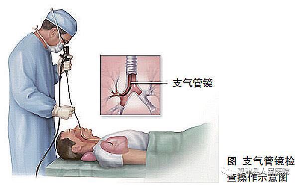 夏津人民医院成功开展首例纤维支气管镜检查